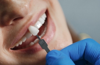 Tipos de implantes dentales y sus principales características