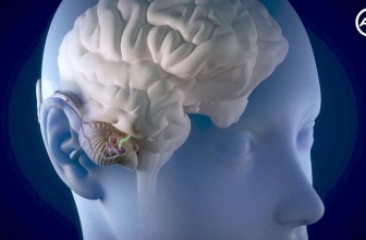 Diferencia entre audífono e implante coclear: ¿Qué me conviene más?